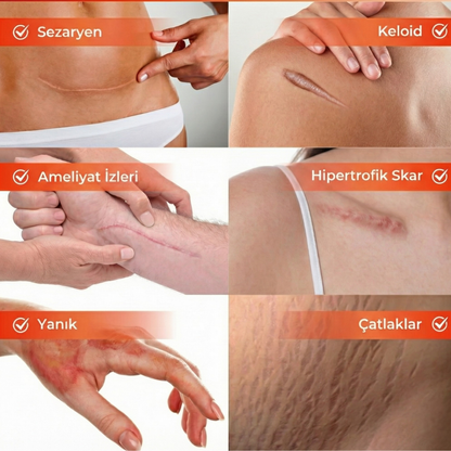 Kolojen Life Yenileyici Bant