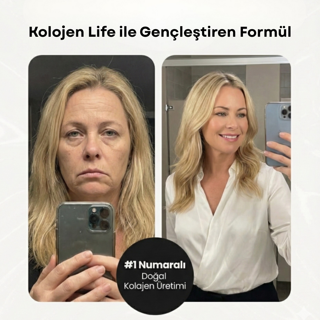 Kolojen Life Yenileyici Bant