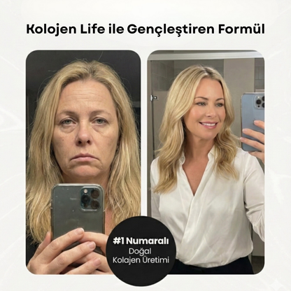 Kolojen Life Yenileyici Bant